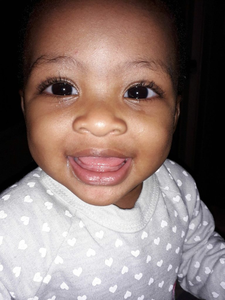 Baby at age 1